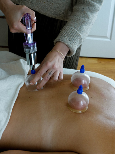 Cupping