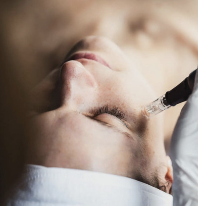 Link to: /pages/microneedling