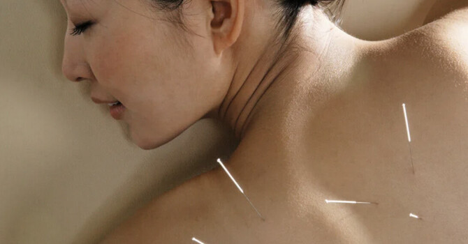 Acupuncture for Anxiety, Depression & Mental Health