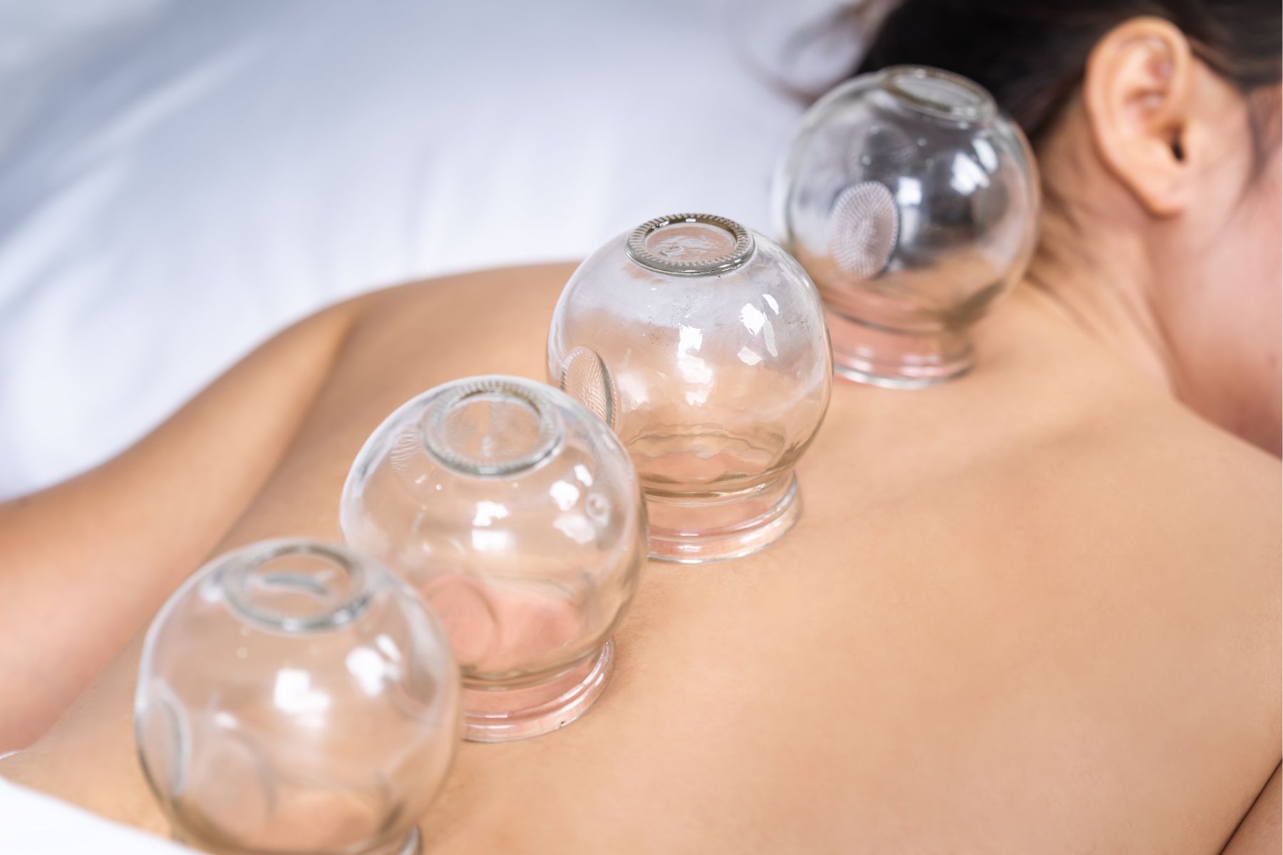 Acupuncture13 weight ne