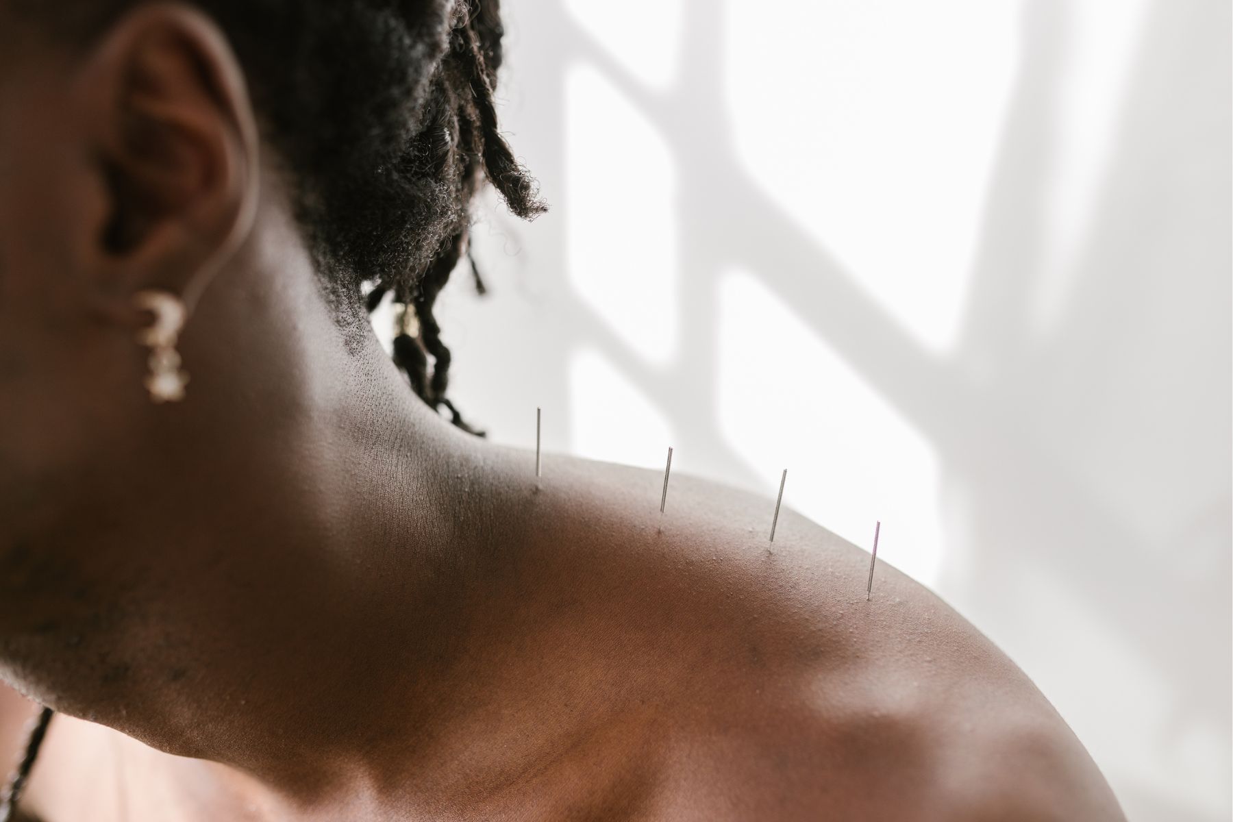 Acupuncture8 weight w
